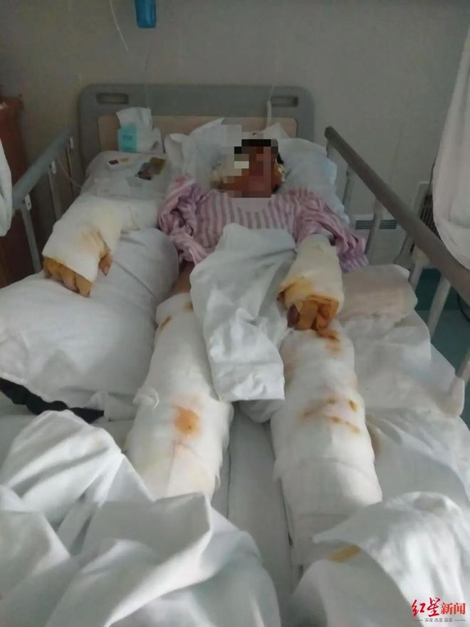 佛山41岁男子求爱未果捅刺并泼硫酸致女子重伤获死刑家属拒赔医疗费！被害人：和他无冤无仇也没要过他一分钱目前生活难以自理(图1)